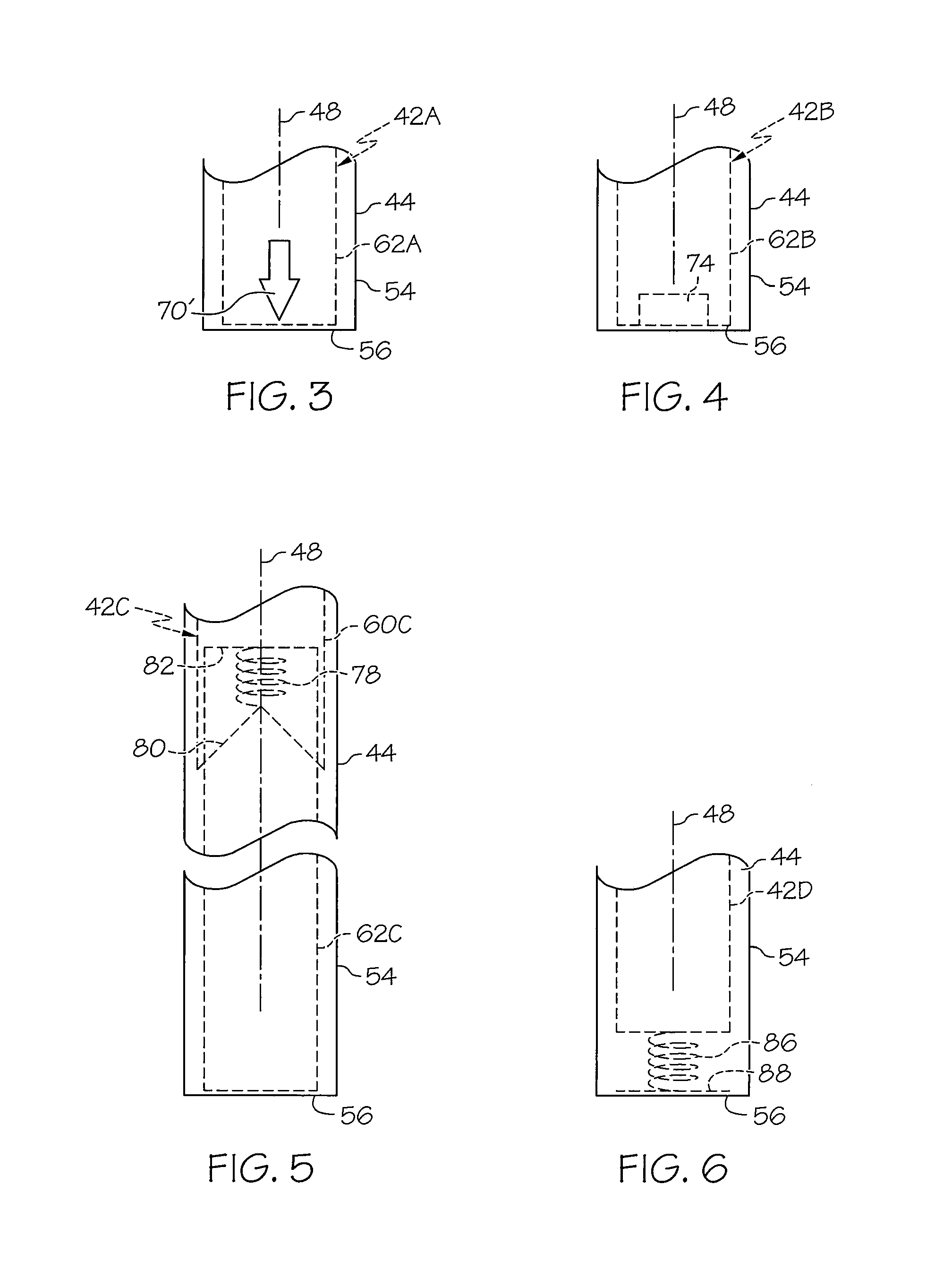 Variable length bag cage