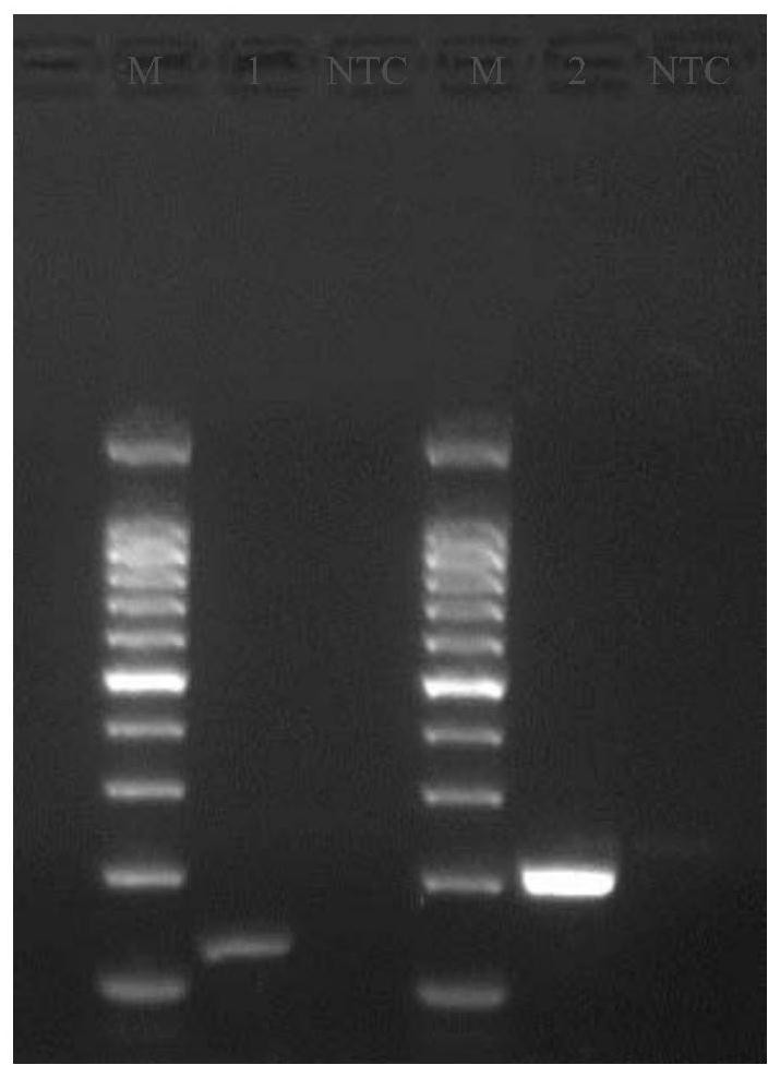 Kit and special primer for detecting GI.1 type norovirus in clinical sample