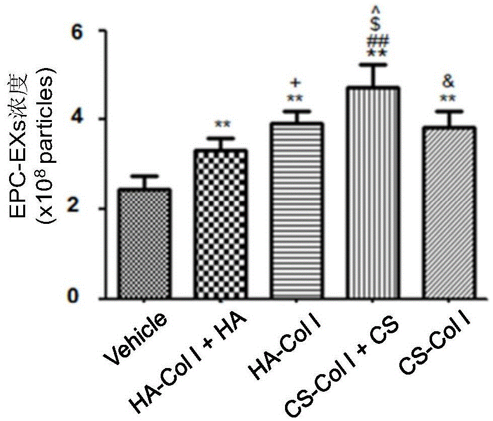 Biological material for improving release of endothelial progenitor cell exosomes (EPC-EXs) and promoting bone defect repair, and preparation method and application thereof