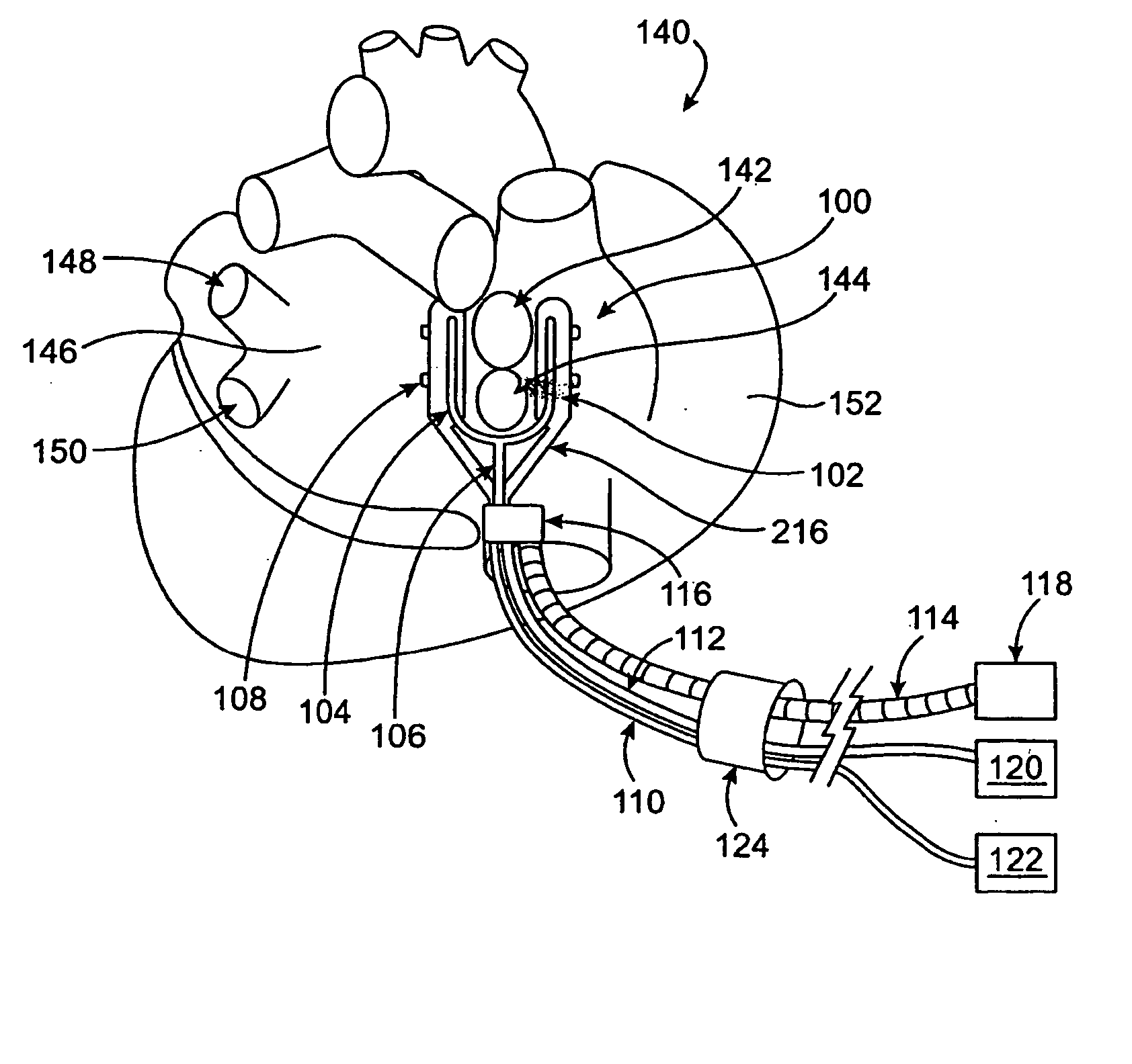 Cardiac treatment devices and methods