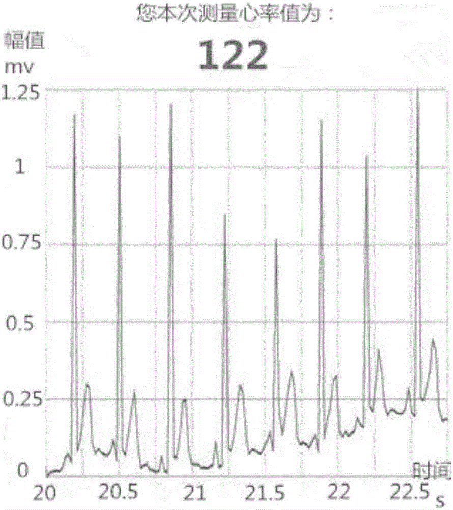 System and method for intelligent video monitoring of vital signs