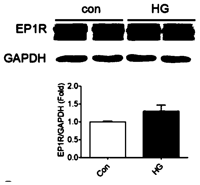 Application of prostaglandin E2 receptor targeting drug in treatment of diabetic retinopathy