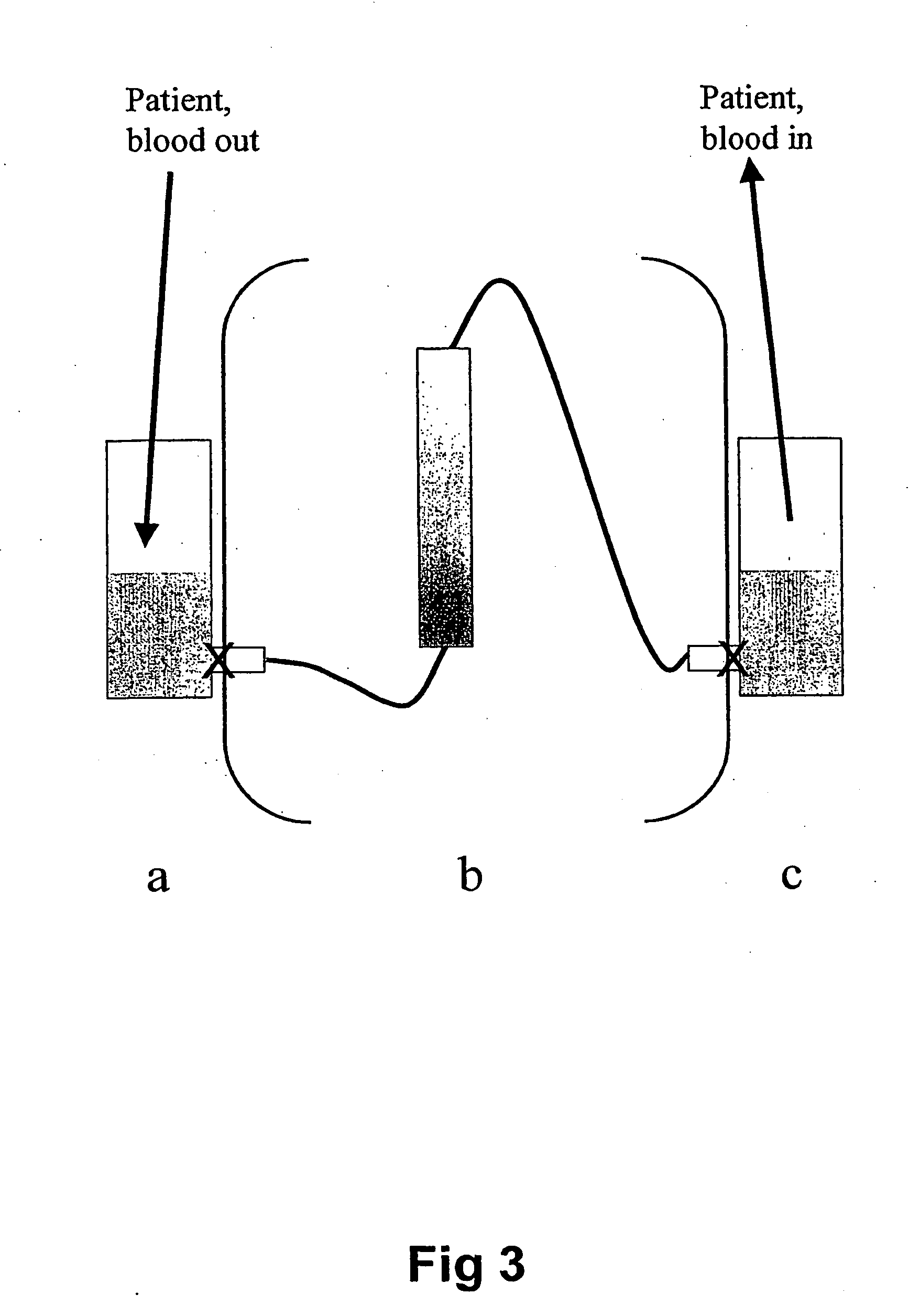 Extracorporeal stablised expanded bed adsorption method for the treatment of sepsis