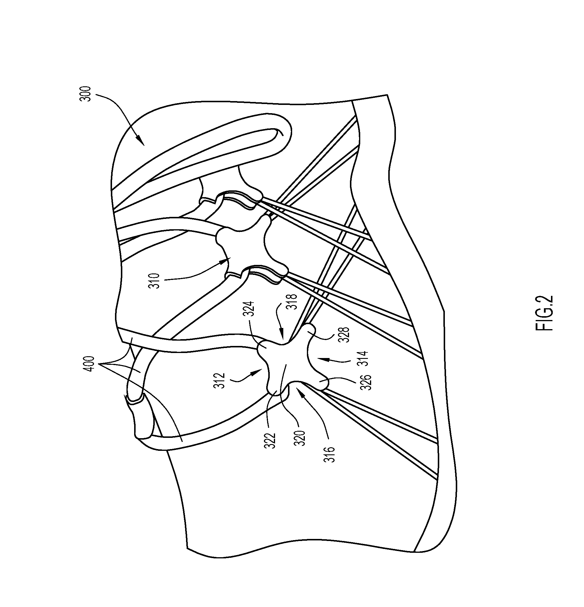 Article of footwear with dynamic tensioning system