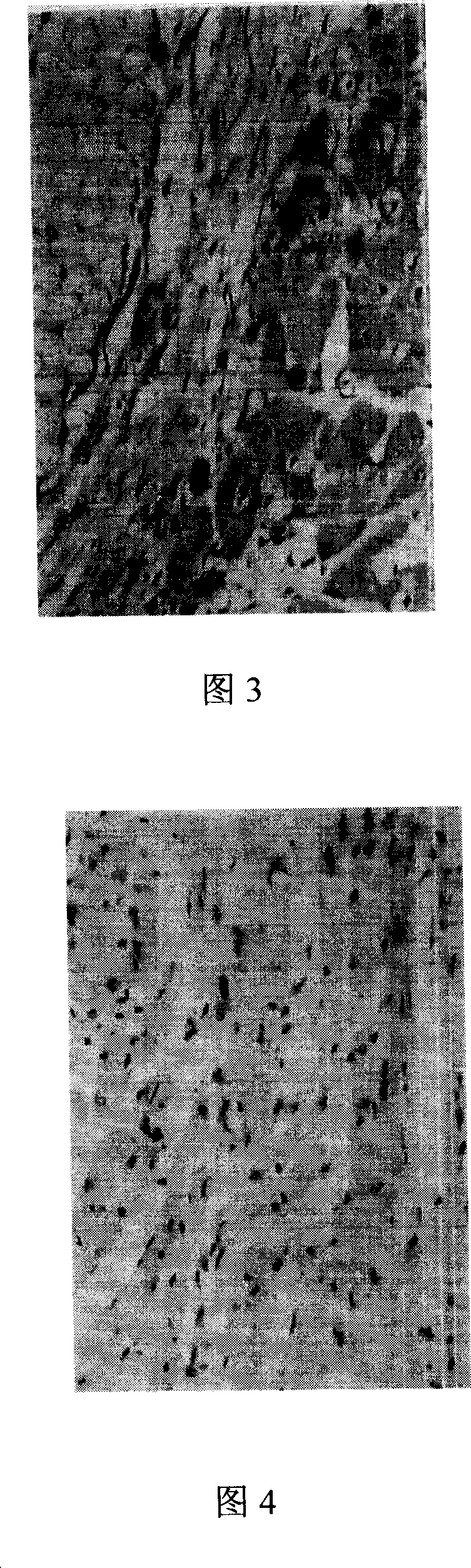 TPA gene thread and its preparation method