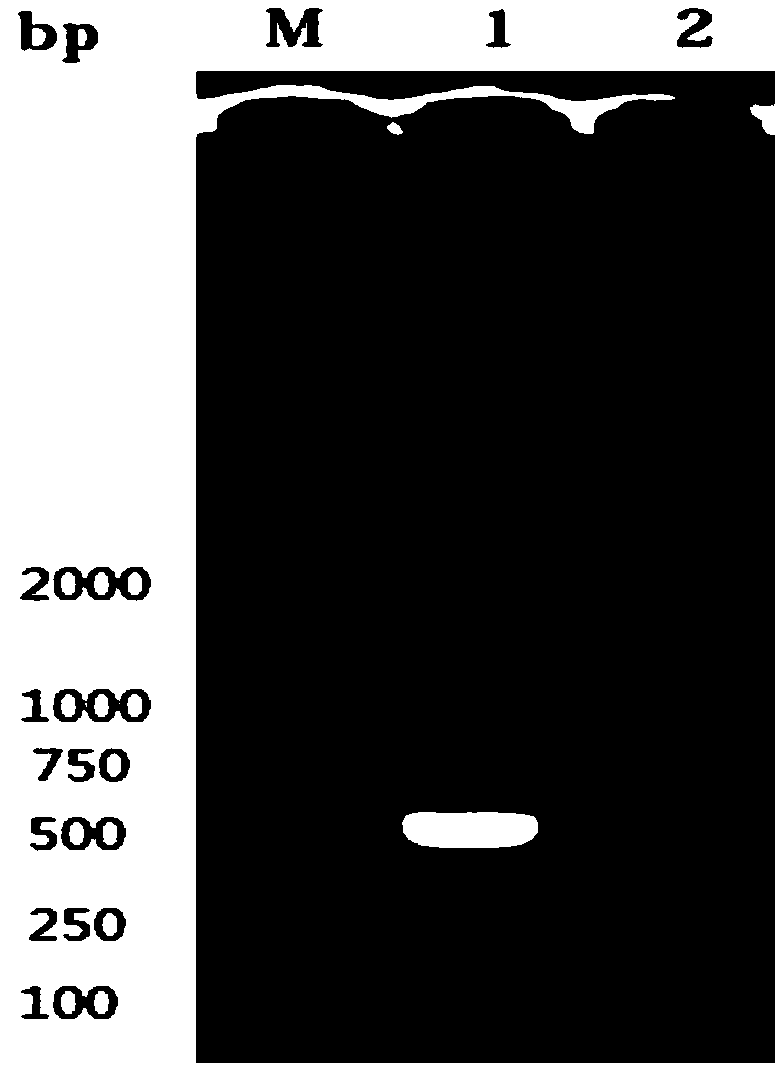 Egg yolk antibody for treating novel reovirus of chicken and preparation method thereof