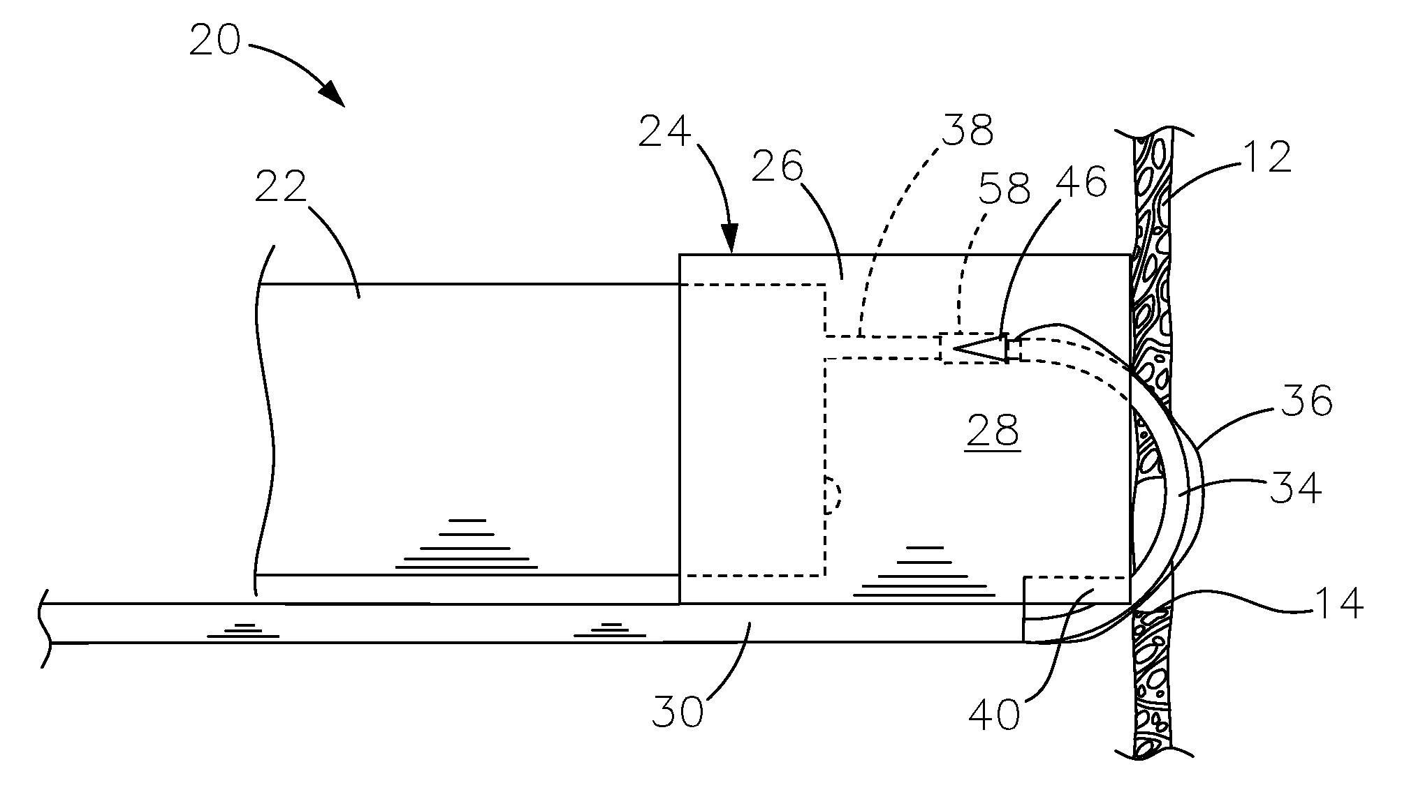 Medical systems, devices and methods for suturing perforations