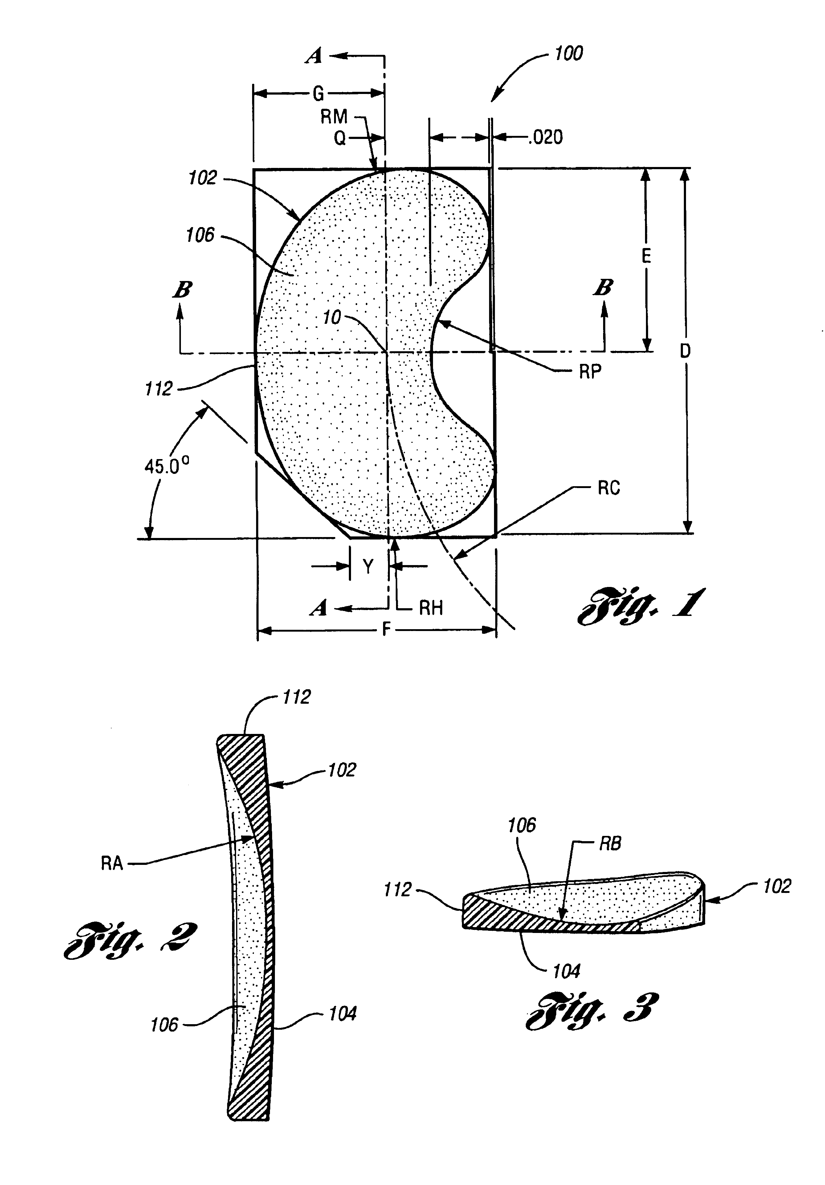 Surgically implantable knee prosthesis having attachment apertures