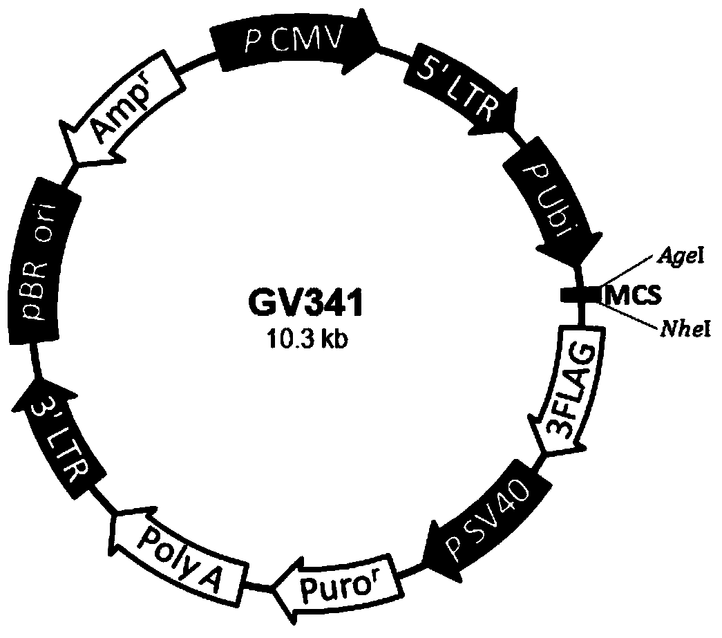 An immortalized human liver cancer vascular endothelial cell line and its preparation method and application