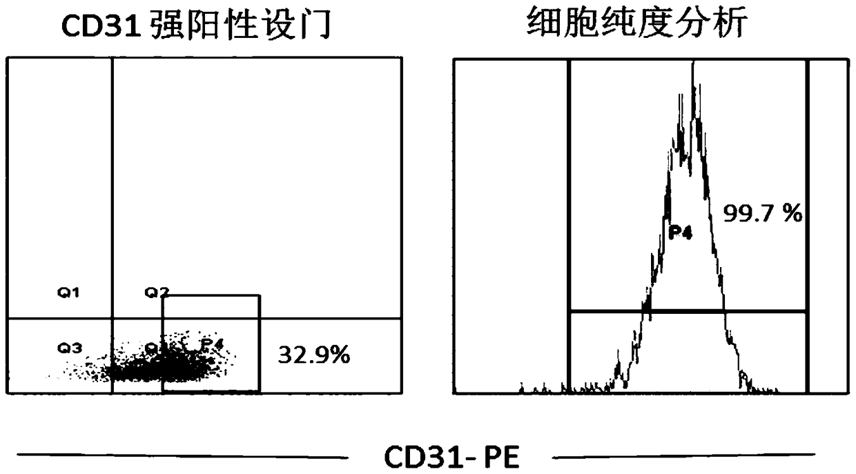 An immortalized human liver cancer vascular endothelial cell line and its preparation method and application