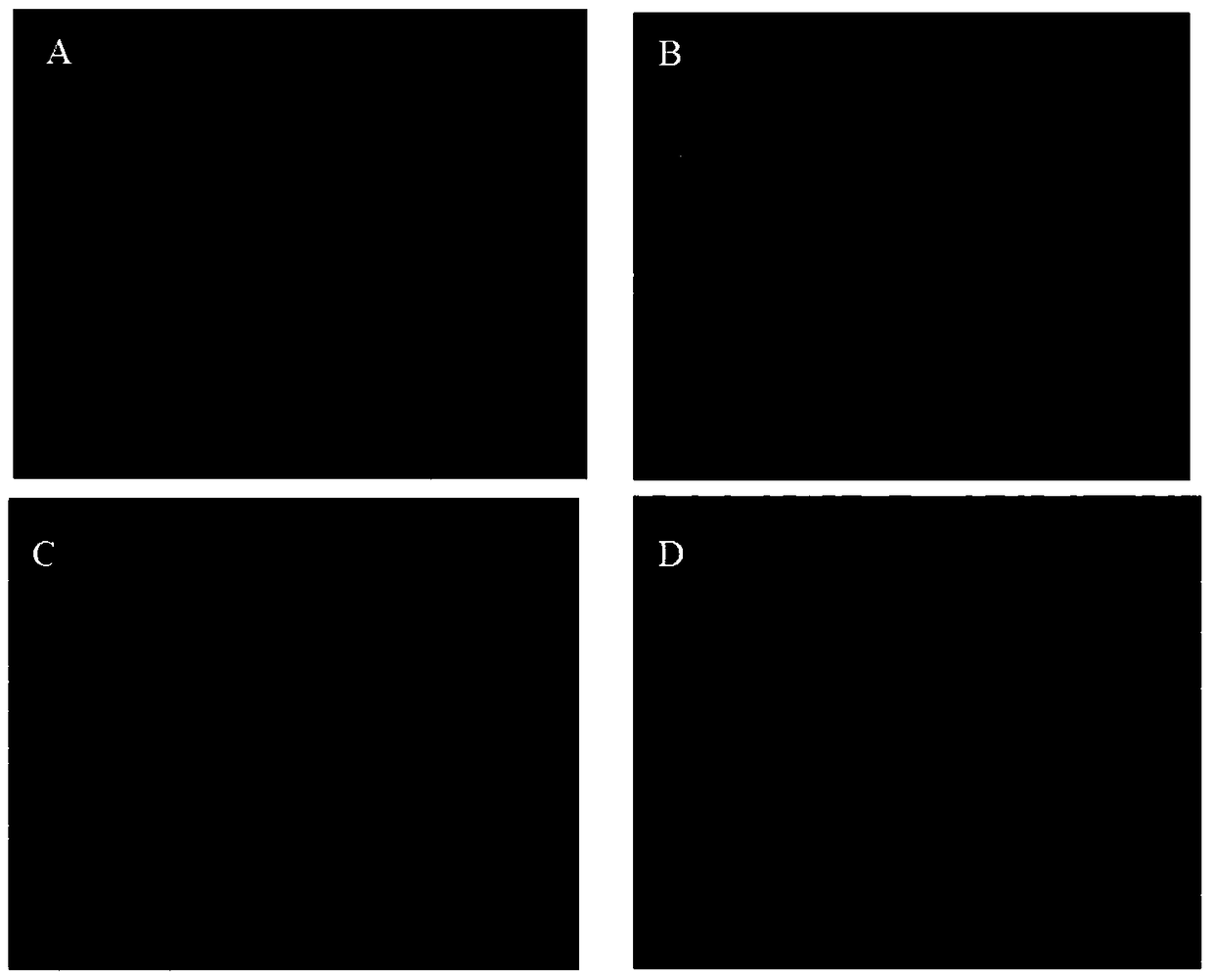 An immortalized human liver cancer vascular endothelial cell line and its preparation method and application