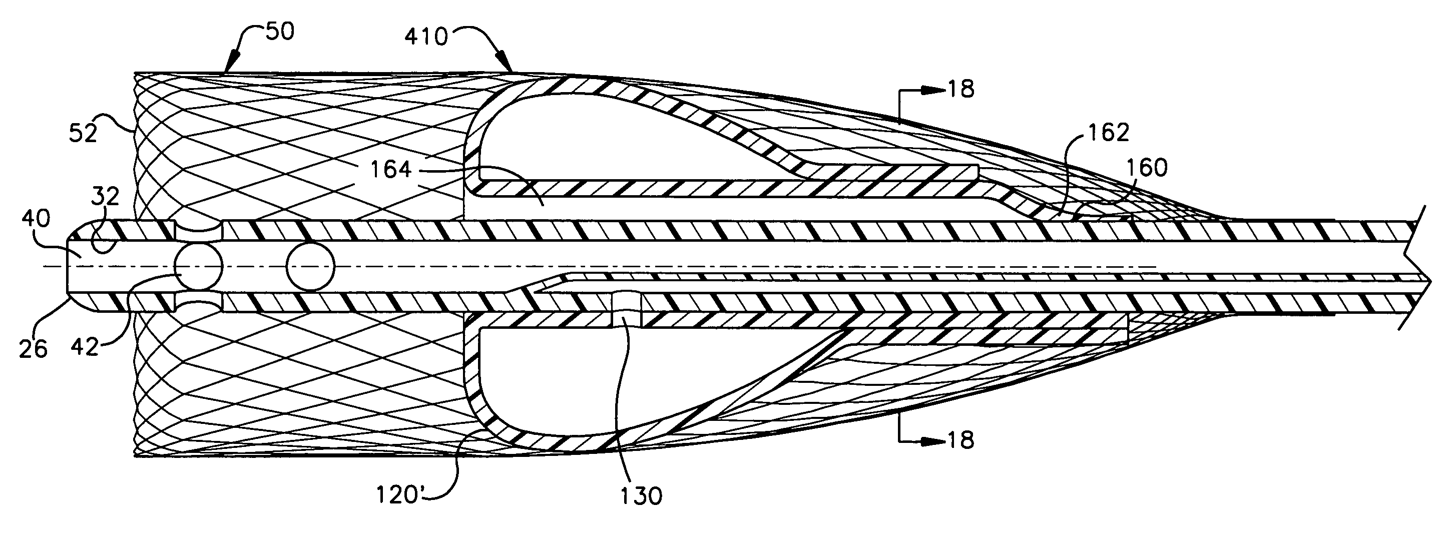 Apparatus for auto-retroperfusion of a coronary vein