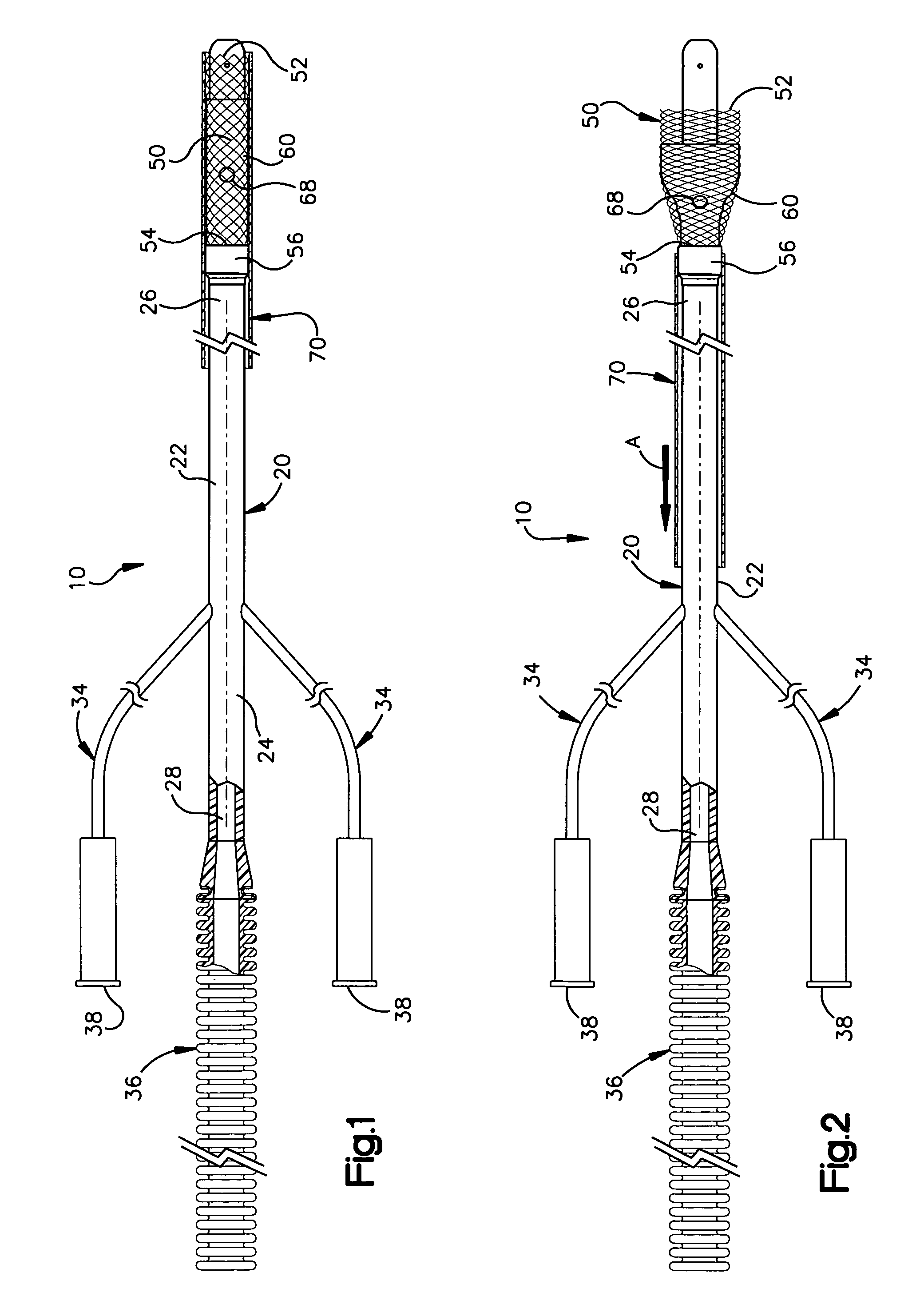 Apparatus for auto-retroperfusion of a coronary vein