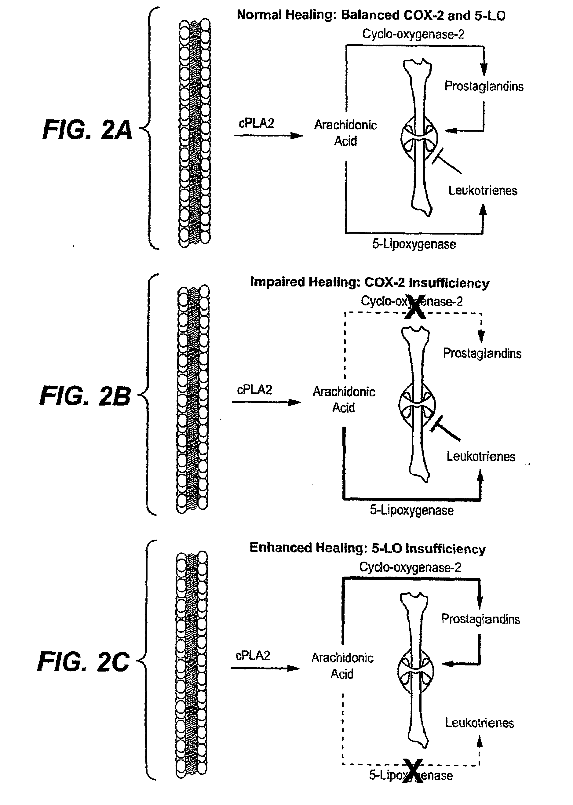 Methods for Bone Treatment by Modulating an Arachidonic Acid Metabolic or Signaling Pathway