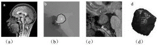 MR (magnetic resonance) image three-dimensional interactive segmenting method for random walks and graph cuts based active contour model