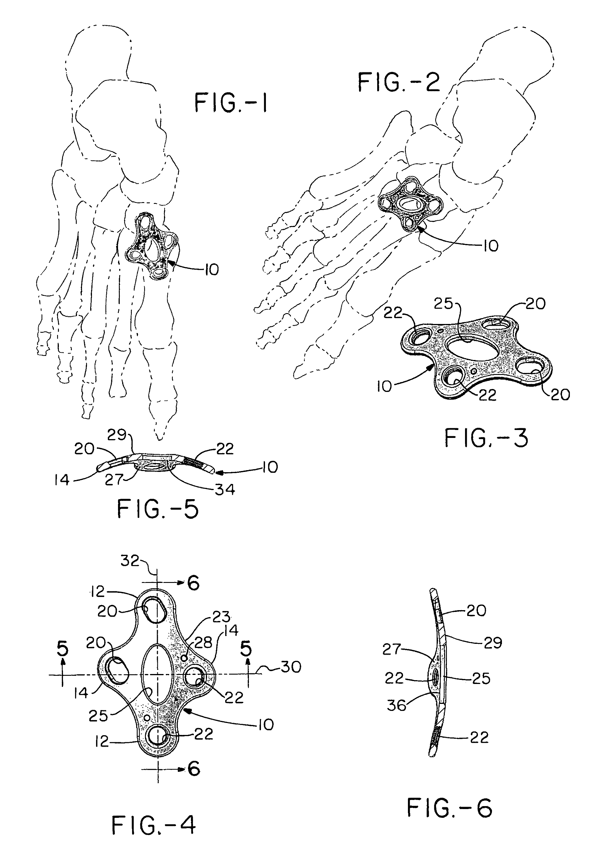 Orthopedic plate for use in the midfoot