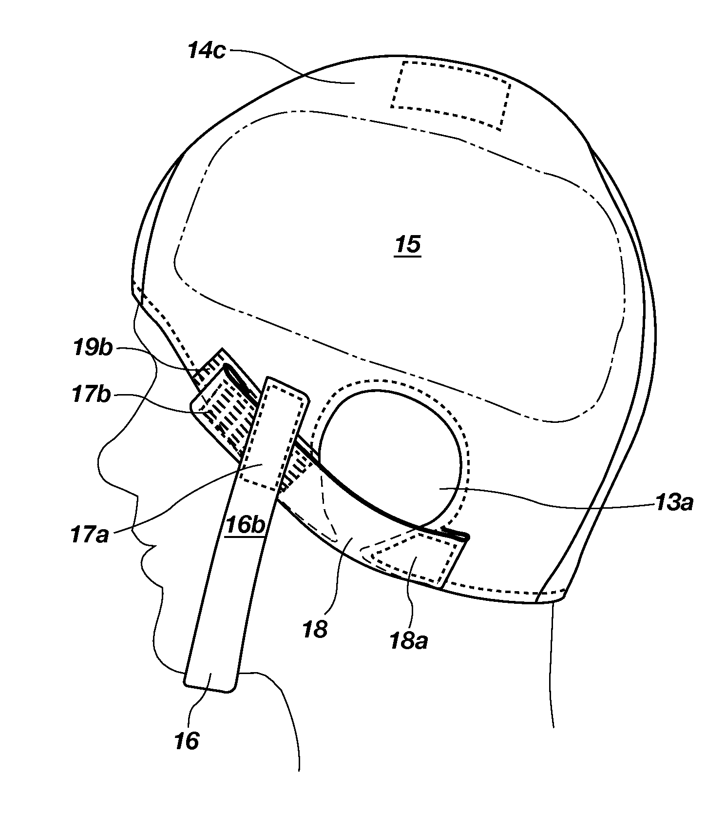 Head Trauma Bandage Cap and Method