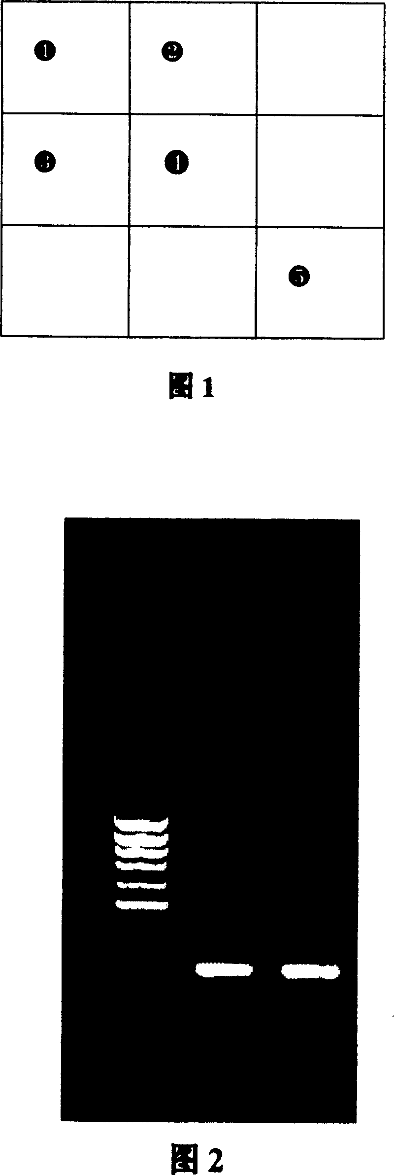 Method of detecting apolipoprotein E gene type and kit