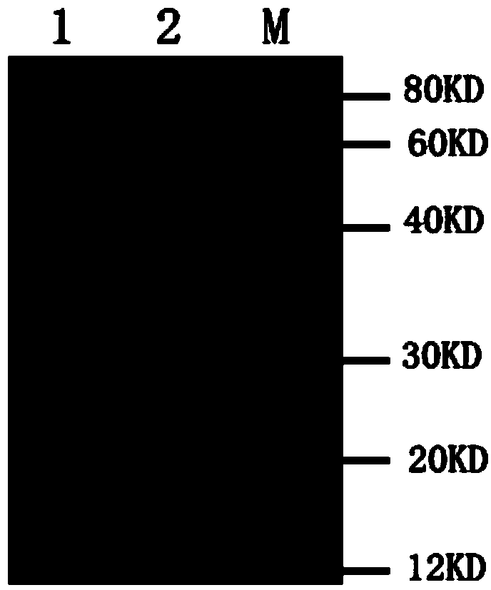 Therapeutic monoclonal antibody for resisting escherichia coli infection, hybridoma cell strain generating monoclonal antibody and use of therapeutic monoclonal antibody