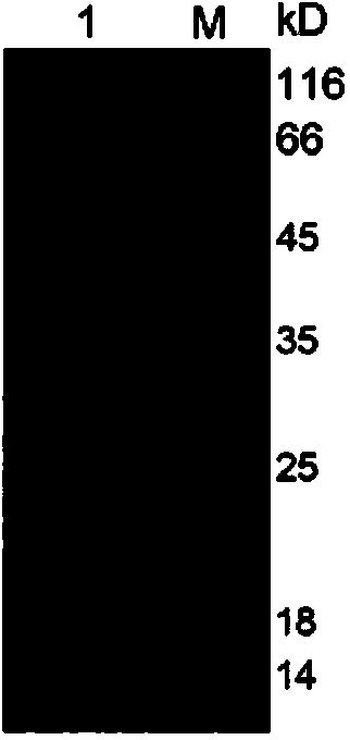 Therapeutic monoclonal antibody for resisting escherichia coli infection, hybridoma cell strain generating monoclonal antibody and use of therapeutic monoclonal antibody