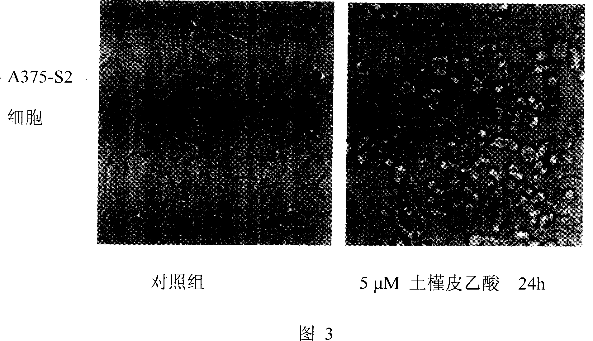 Function of pseudolarix acetic acid as medicine for inducing tumor cells to die