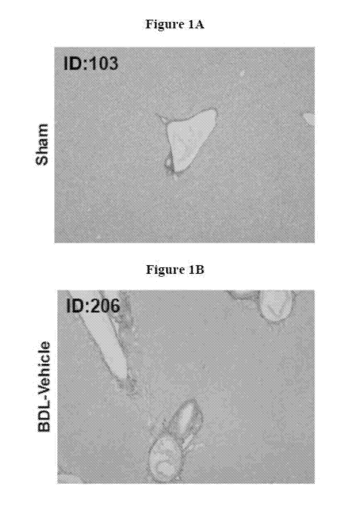 Pharmaceutical compositions for combination therapy