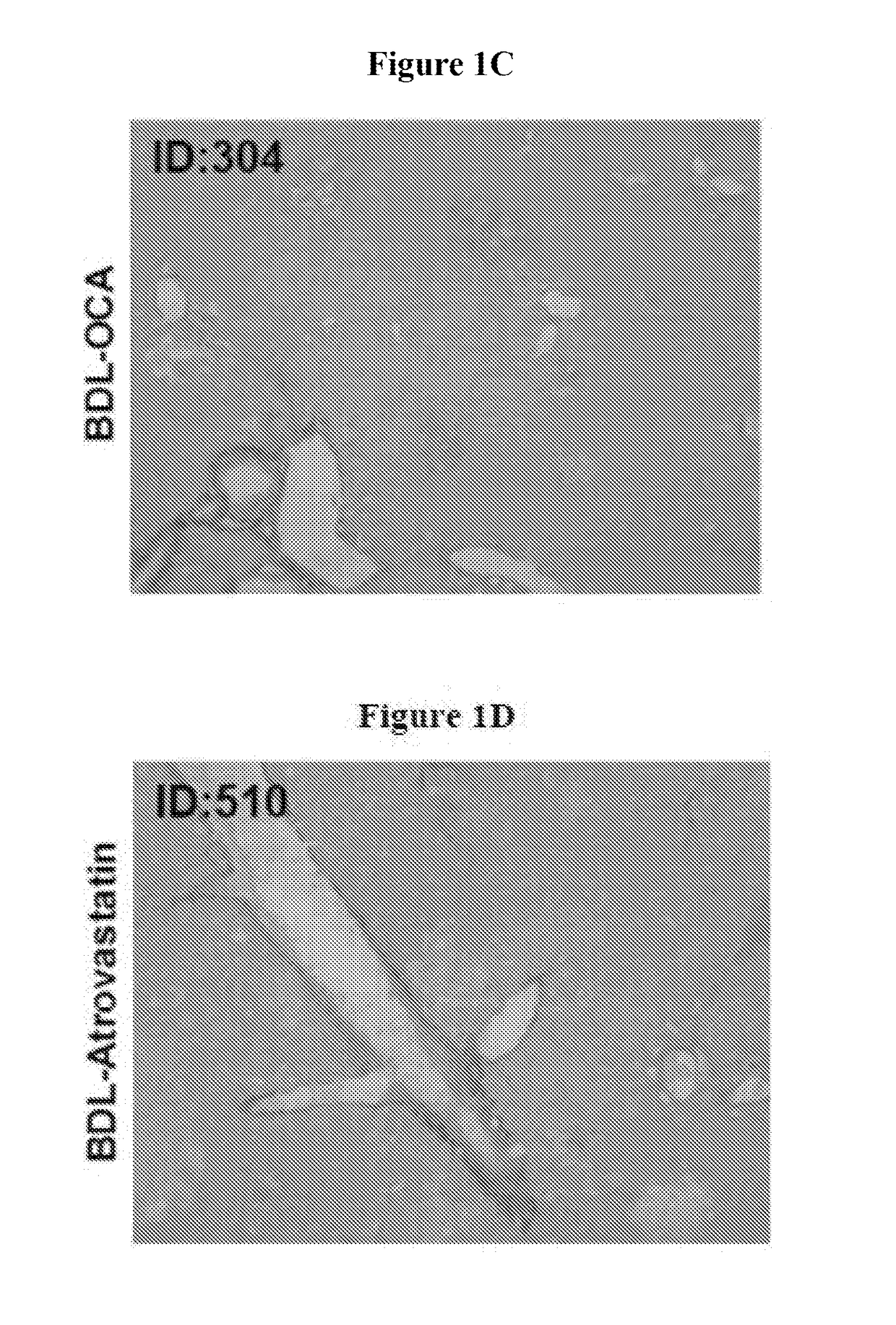 Pharmaceutical compositions for combination therapy