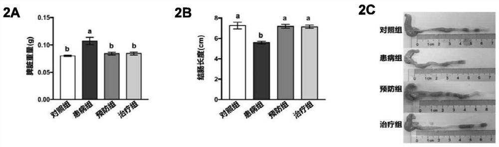 Application of lactobacillus johnsonii in preventing and/or treating inflammatory bowel diseases