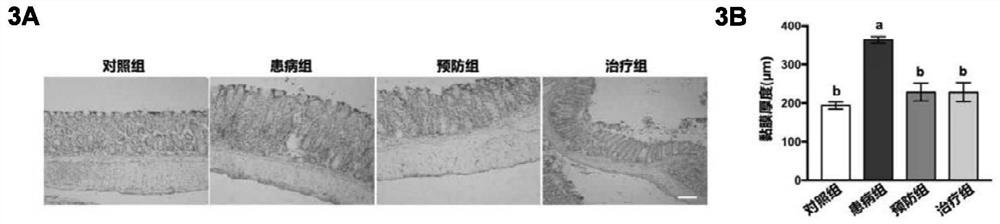 Application of lactobacillus johnsonii in preventing and/or treating inflammatory bowel diseases