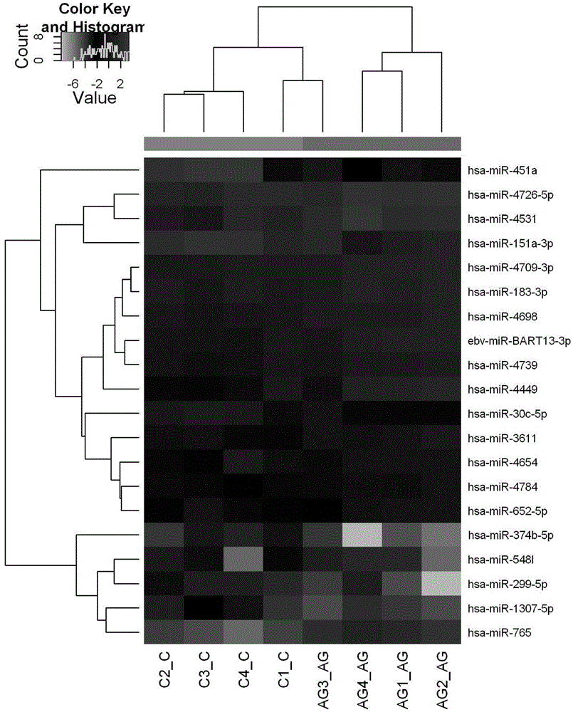 Gout serum miRNAs biomarkers and method for detecting expression quantity thereof