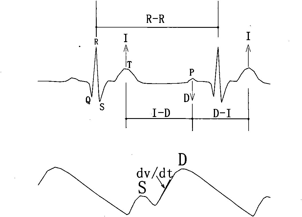 Optimal counter-pulsation parametric measuring method