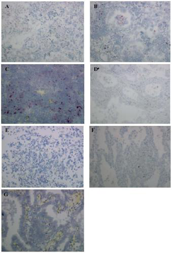 Kit and method for detecting programmed cell death 1 ligand 1 (PD-L1) mRNA on tissue