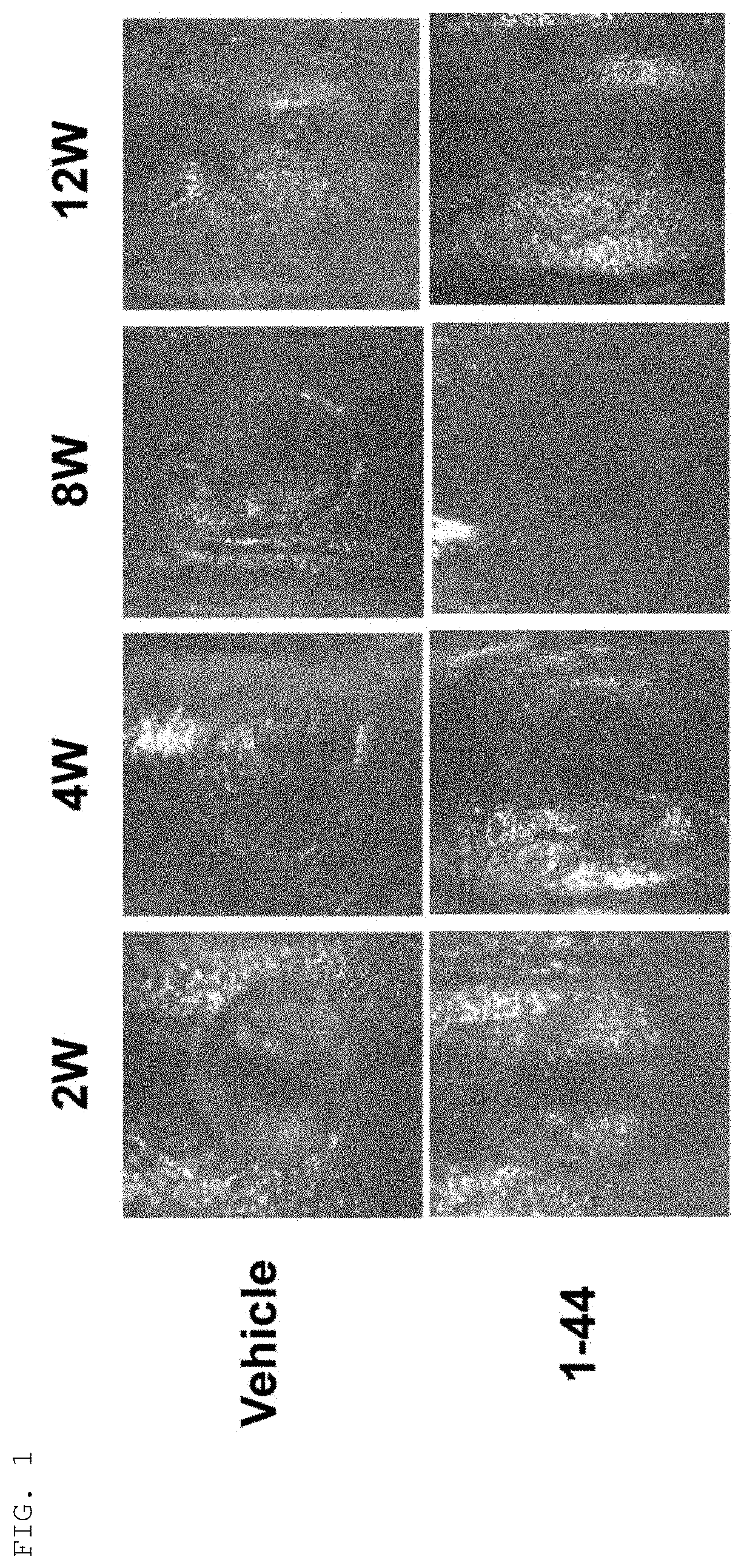 Therapeutic agent for cartilage disorder