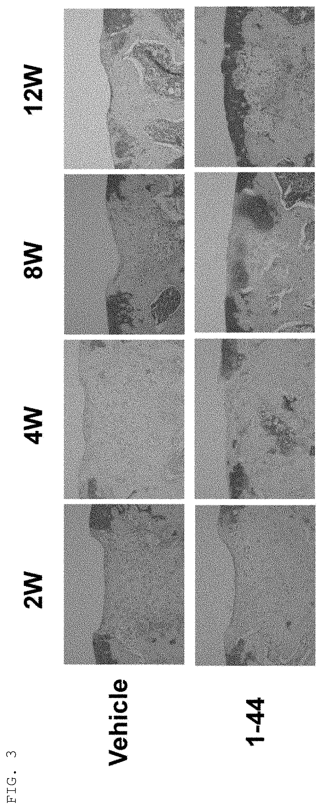 Therapeutic agent for cartilage disorder