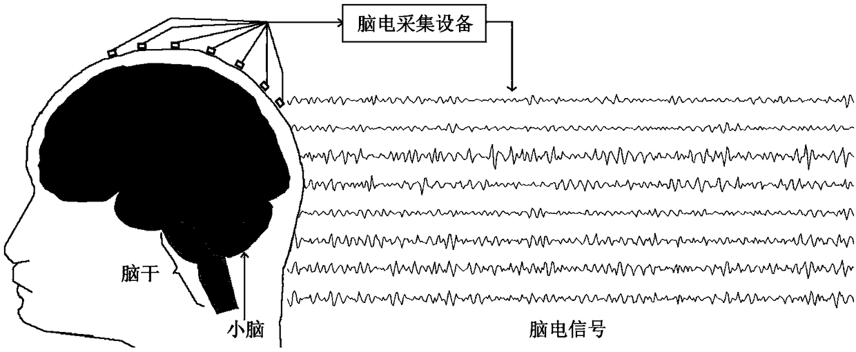 Lead selection method for emotional electroencephalogram based on independent component analysis