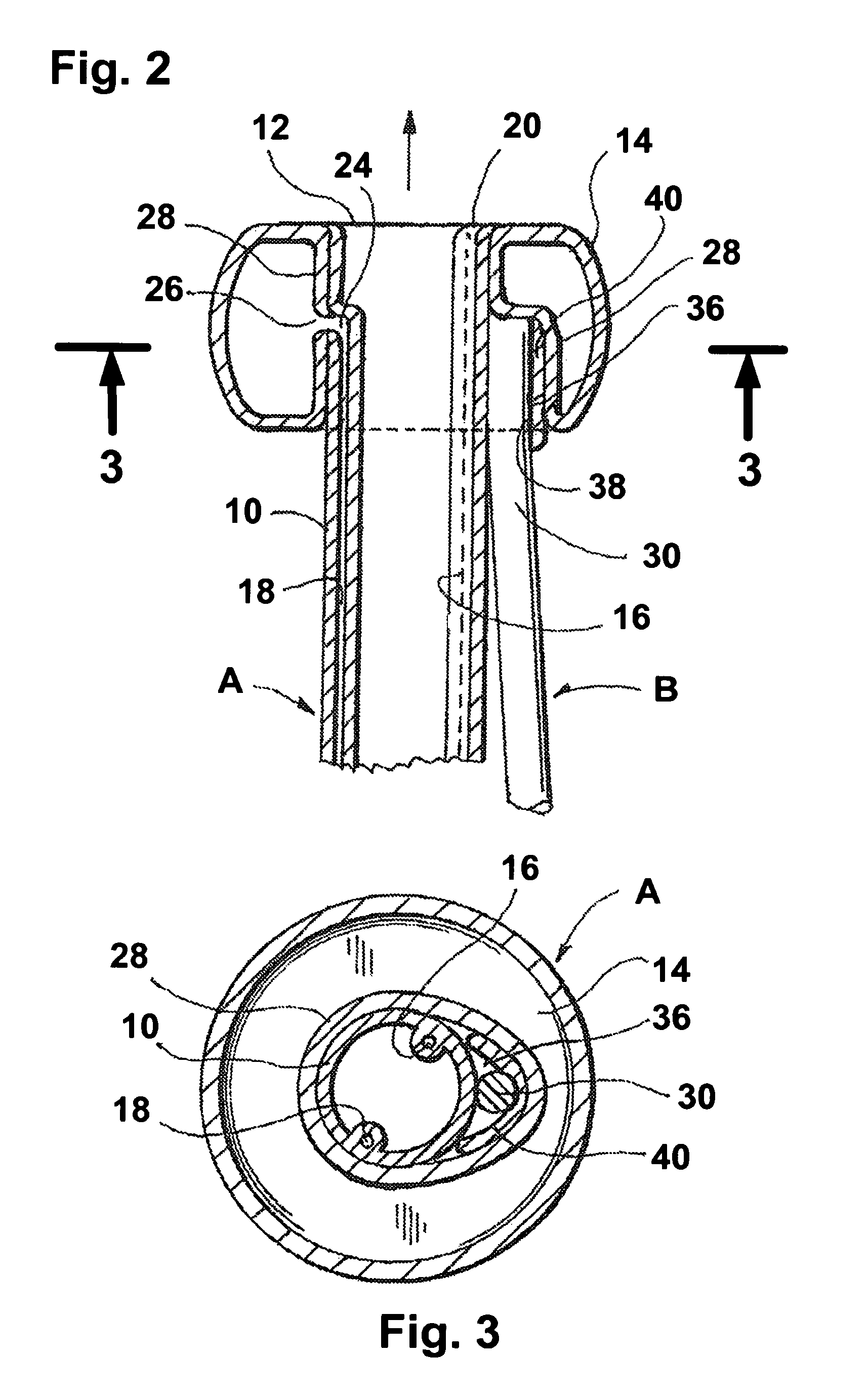 Balloon catheter with positioning pocket