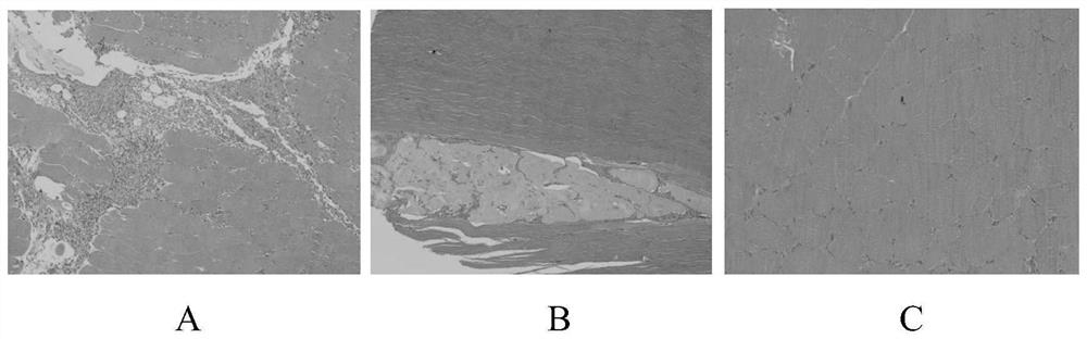 Preparation method of marine plant polysaccharide anti-adhesion material