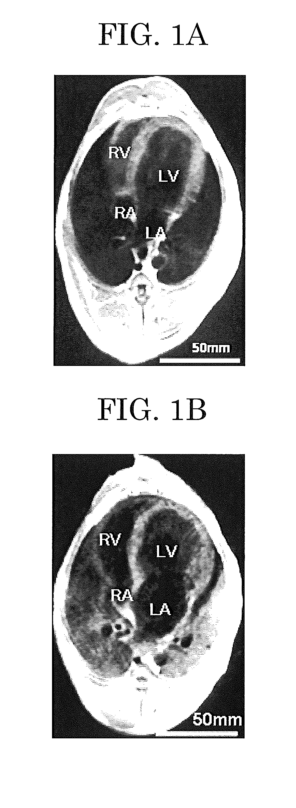 Method for preventing or treating arrhythmia, method for preventing or treating atrial fibrillation, model of sustained atrial fibrillation, method for producing the model, and method for screening for atrial fibrillation inhibitor