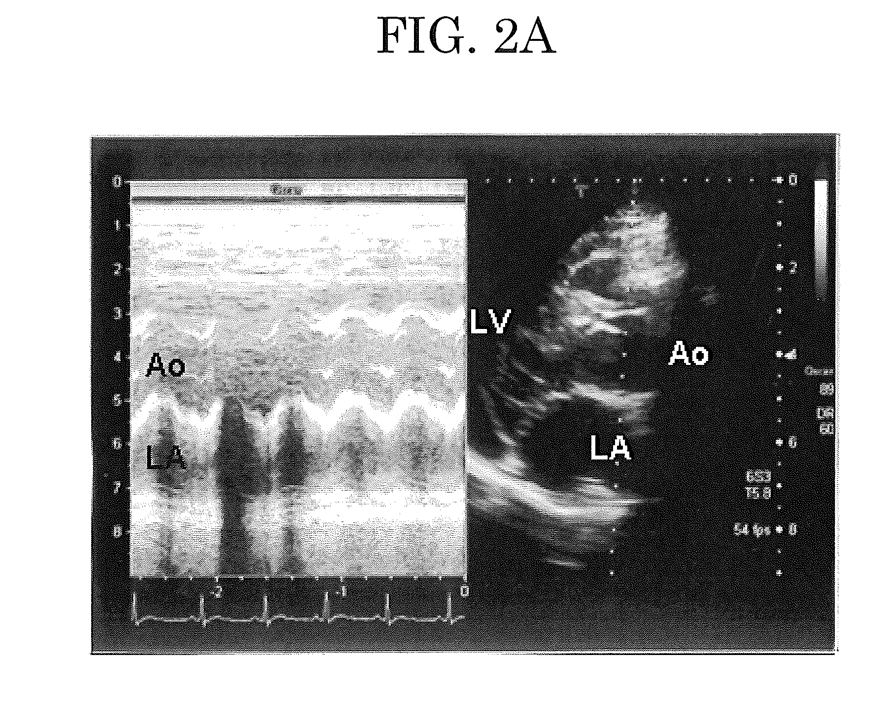 Method for preventing or treating arrhythmia, method for preventing or treating atrial fibrillation, model of sustained atrial fibrillation, method for producing the model, and method for screening for atrial fibrillation inhibitor