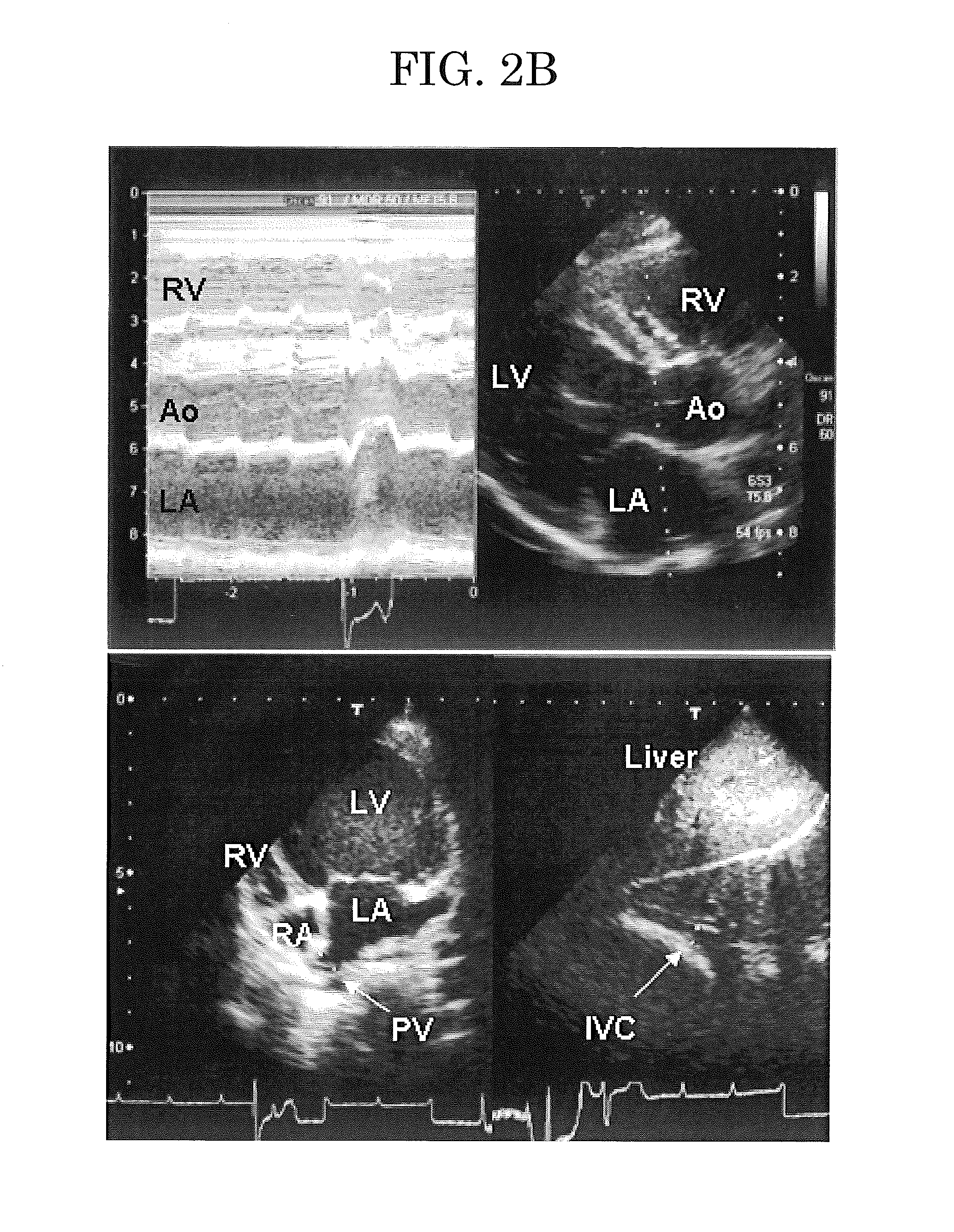 Method for preventing or treating arrhythmia, method for preventing or treating atrial fibrillation, model of sustained atrial fibrillation, method for producing the model, and method for screening for atrial fibrillation inhibitor