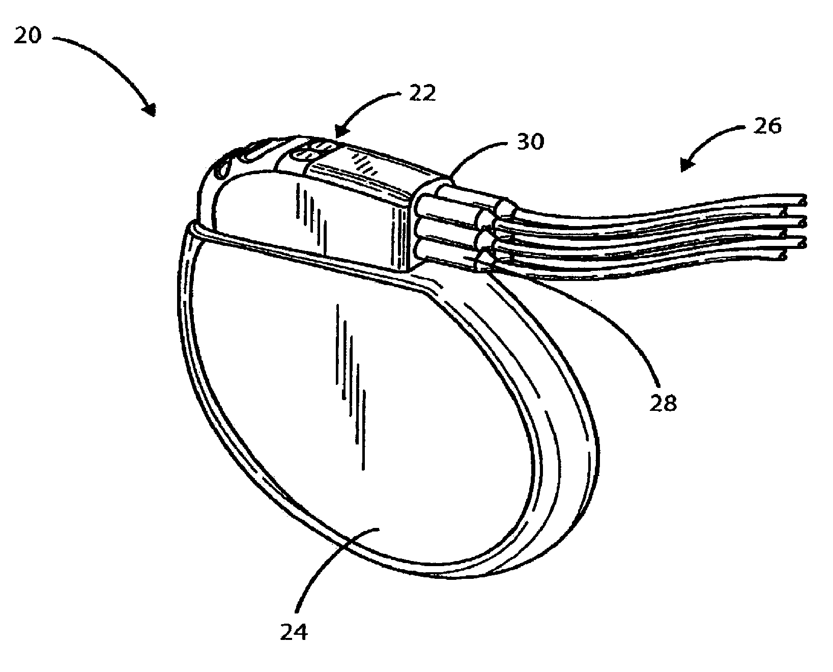 Interconnect for implantable medical device header