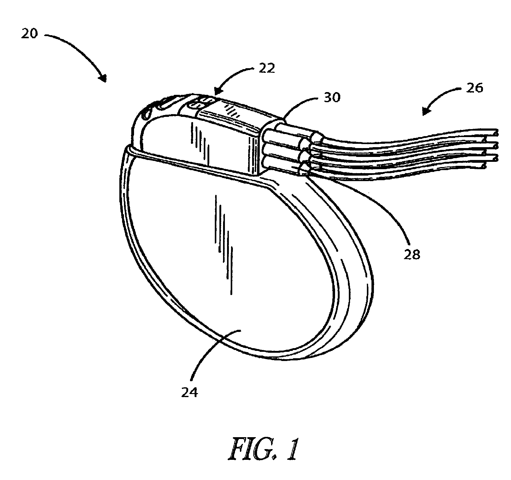 Interconnect for implantable medical device header