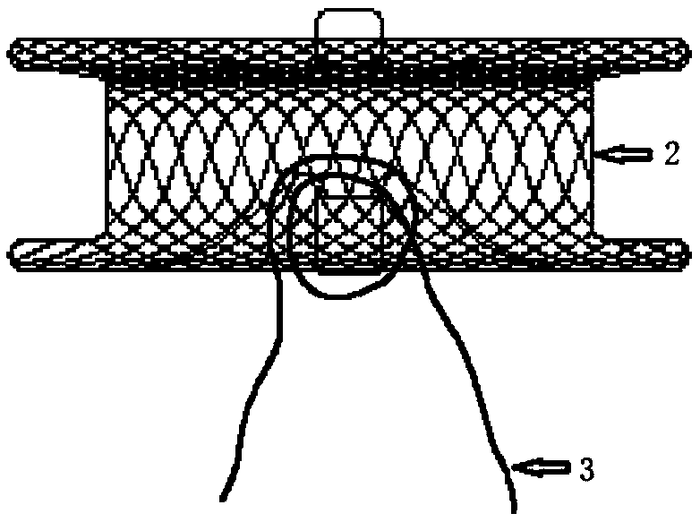 Safety device and method for preventing heart implanting device from shedding and application thereof