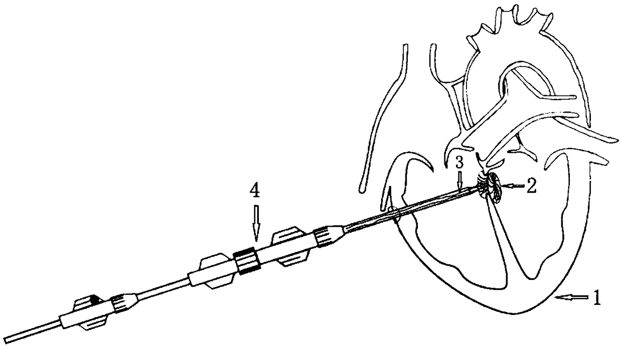 Safety device and method for preventing heart implanting device from shedding and application thereof