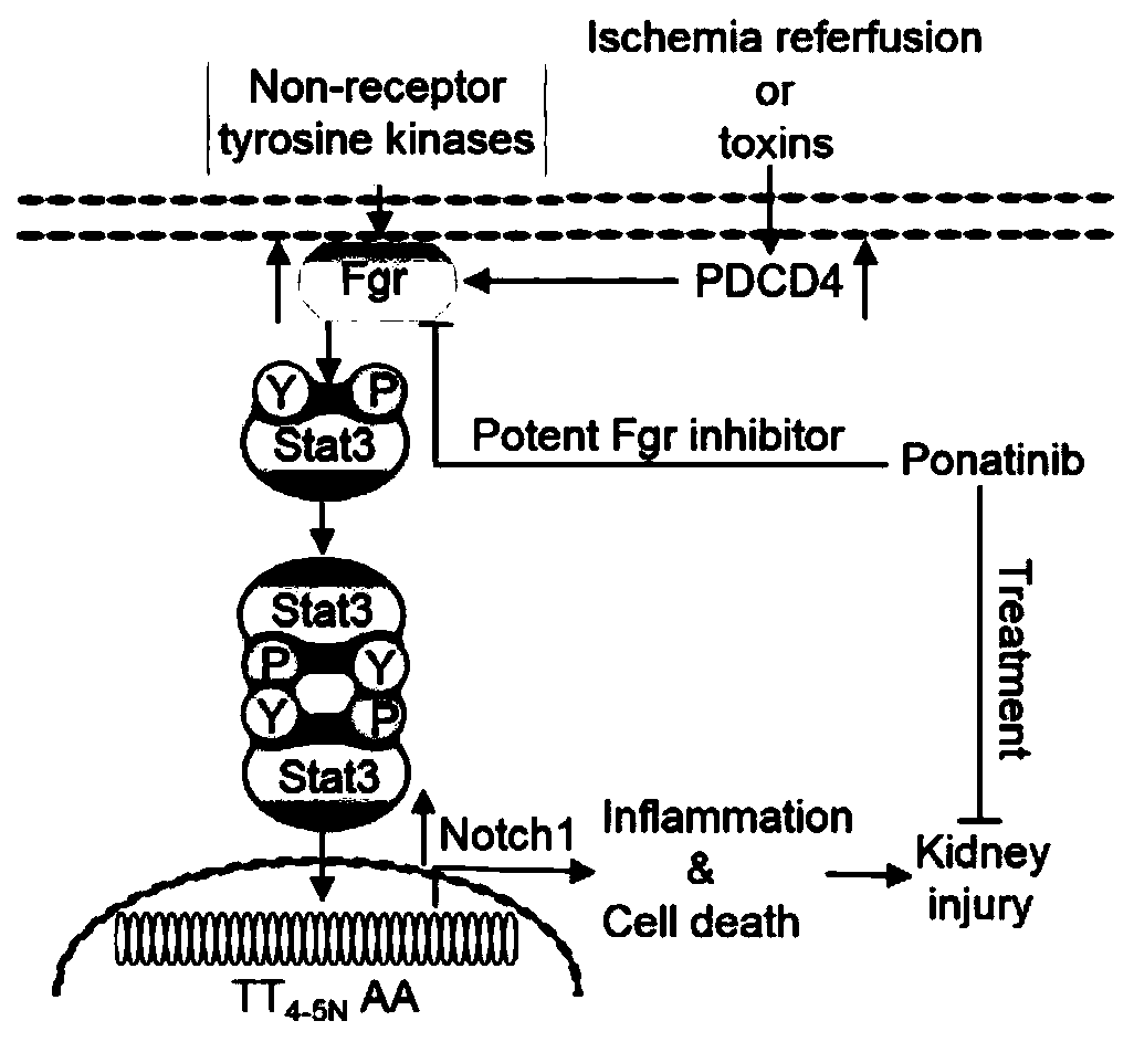 Application of tyrosine kinase inhibitor as treatment drug for acute kidney injury