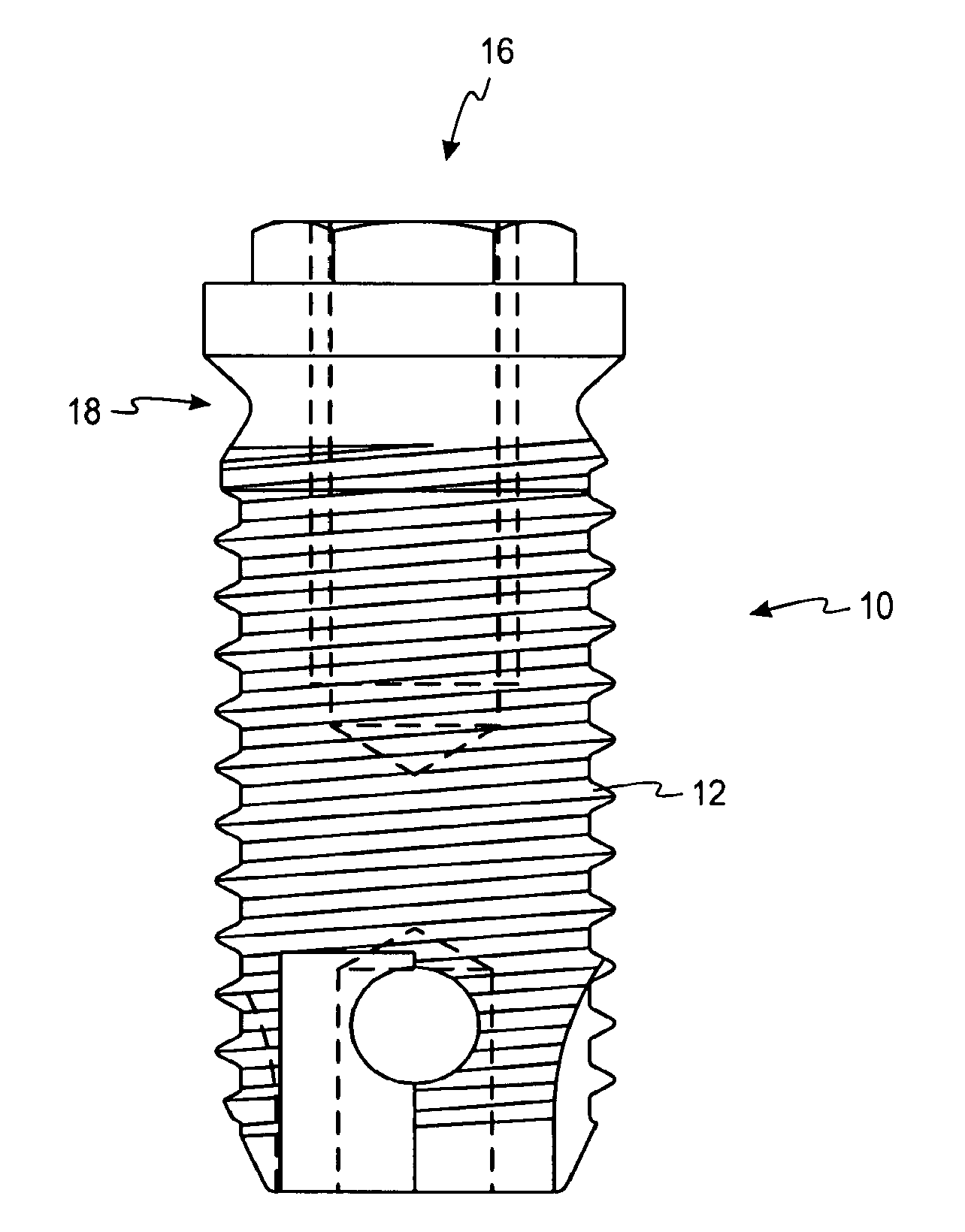 Surface treatment process for implants made of titanium alloy