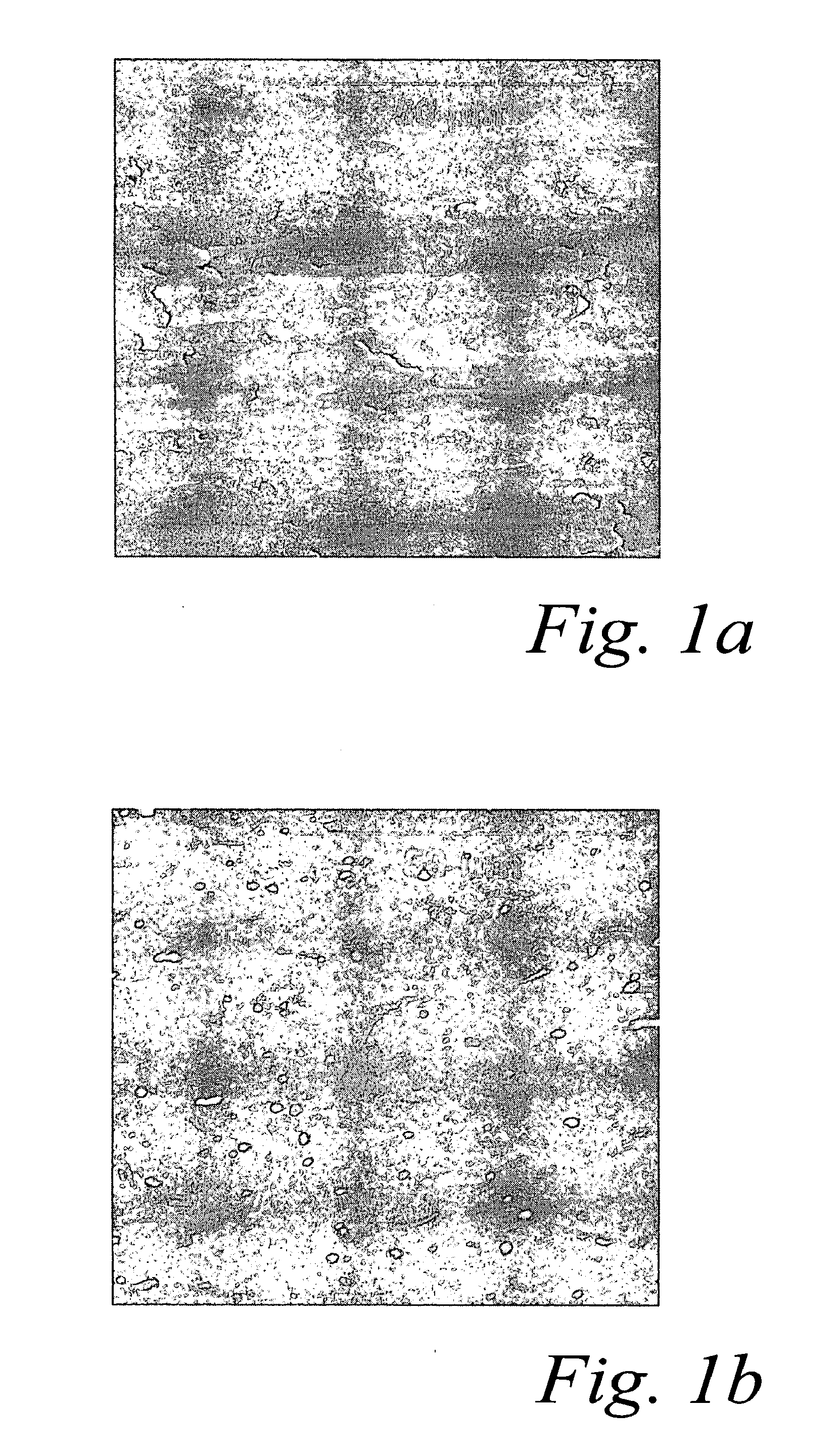 Surface treatment process for implants made of titanium alloy