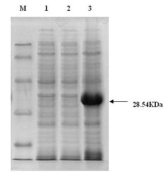 Soybean MYB (v-myb avian myeloblastosis viral oncogene homolog) transcription factor as well as coding gene and application thereof