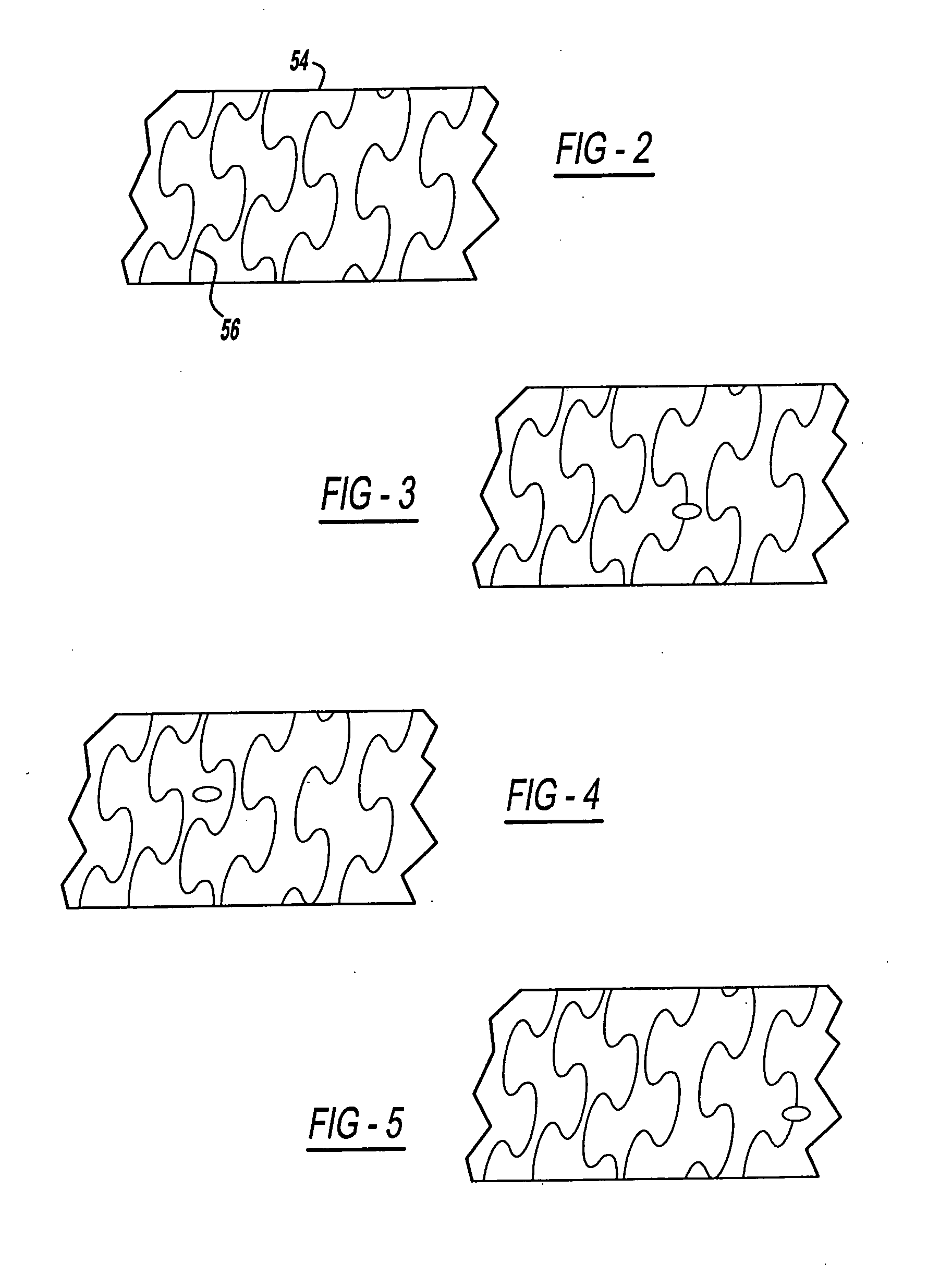 Rapid-exchange balloon catheter shaft and method