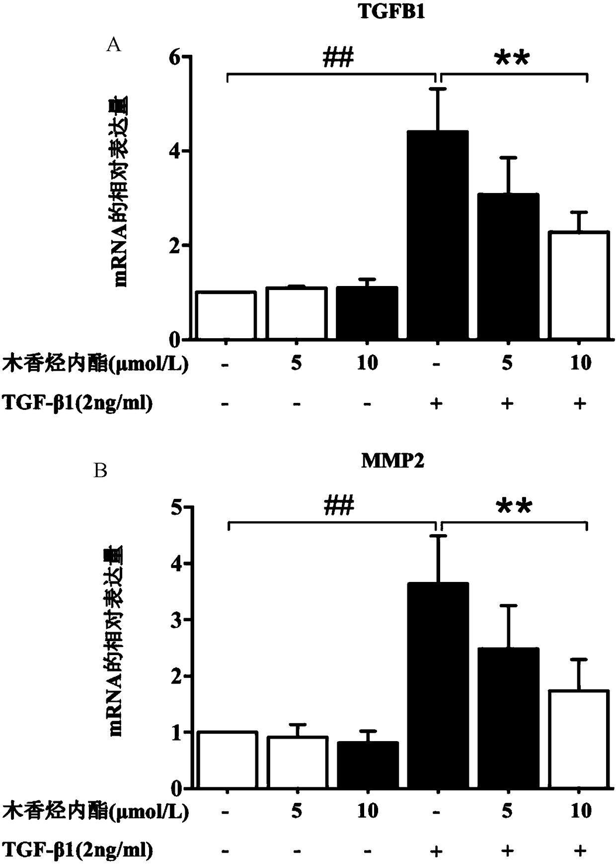 Application of costunolide in preparation of anti-hepatic fibrosis drugs